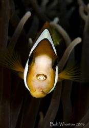 A horrible parasitic isopod that crawls in through the gi... by Dr Bob Whorton 